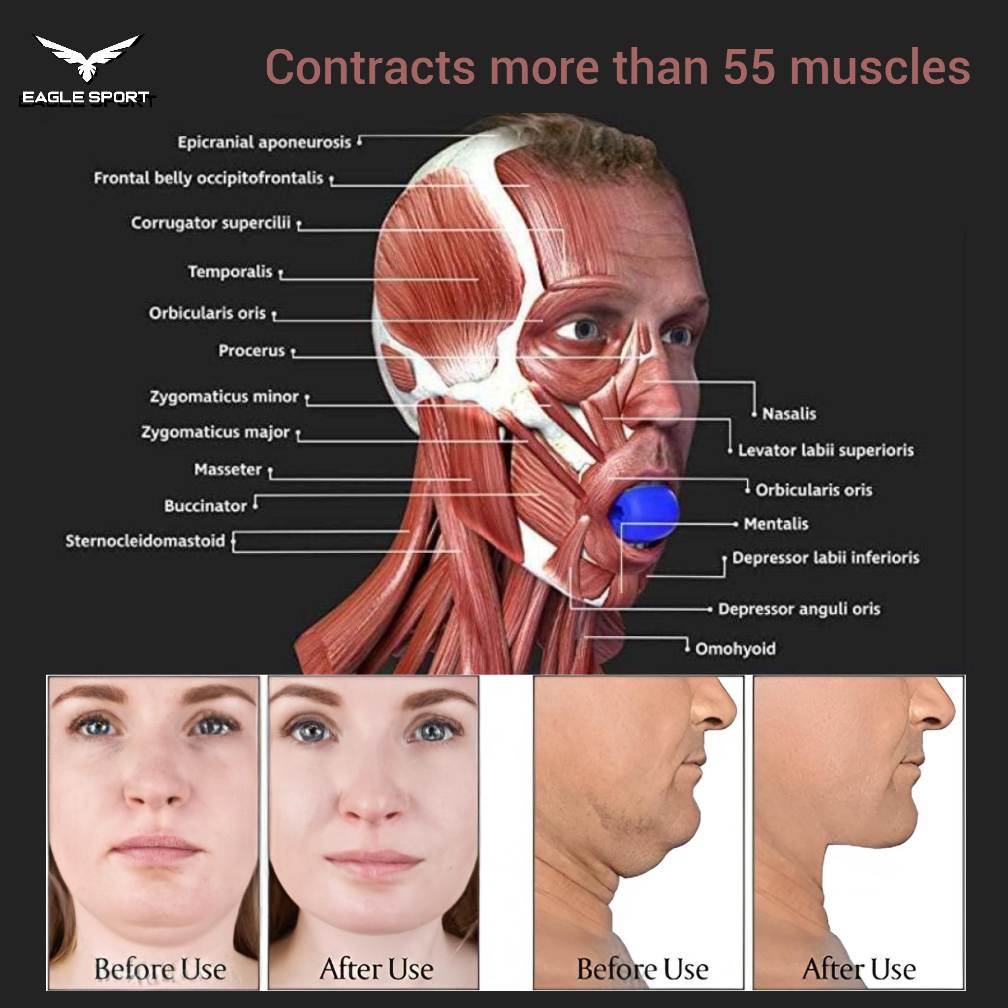 Jaw Exerciser Resistance Set – 4 Pieces
مجموعة تمارين الفك متعددة المقاومات – 4 قطع